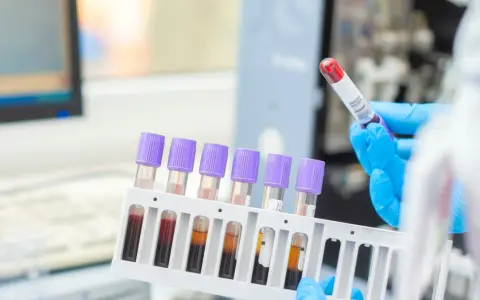 Ręce w niebieskich rękawiczkach trzymają probówki z krwią w stojaku, w tle sprzęt laboratoryjny.