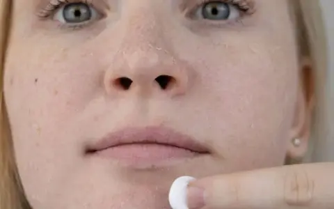Juckende Gesichtshaut: Die wahren Ursachen & effektive Hilfe
