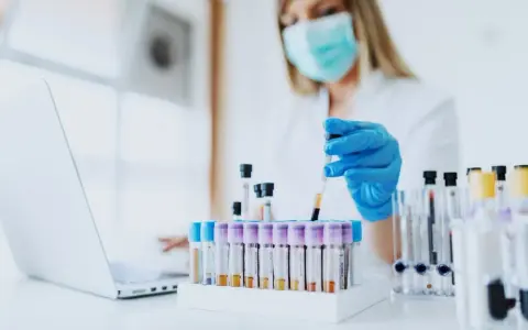 W laboratorium pracownik w maseczce i rękawiczkach pobiera próbkę krwi. Czy do laboratorium trzeba się rejestrować?