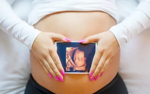 Ręce z różowymi paznokciami obejmują brzuch, na którym widnieje zdjęcie z 8 tygodnia ciąży usg 3d.