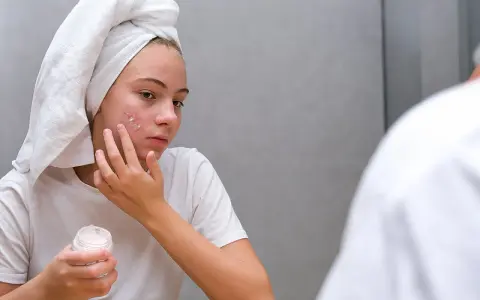 Mädchen mit Handtuch auf dem Kopf trägt Zinksalbe auf Pickel im Gesicht auf.