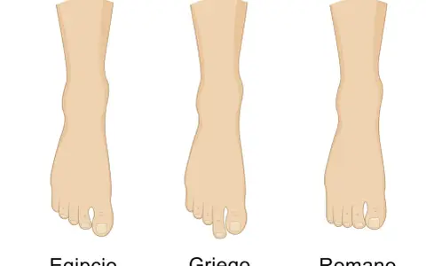 Tres tipos de pies: el pie egipcio con el dedo gordo prominente, el griego con el segundo dedo más largo, y el romano con dedos de longitud similar.