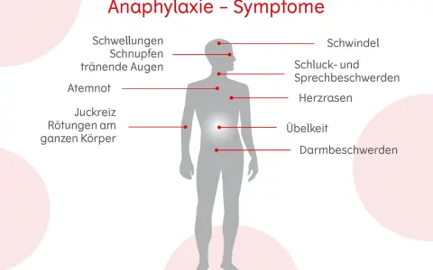 Allergie Symptome: So erkennen Sie gefährliche Reaktionen rechtzeitig