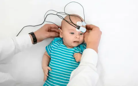Niemowlę z elektrodami na głowie, przygotowywane do badania słuchu. To ważny krok w diagnostyce, by wcześnie wykryć potrzebę zastosowania aparatu słuchowego dla niemowlaka.