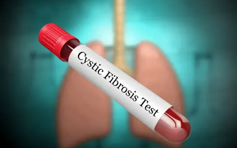 Provette con campione di sangue per il test della fibrosi cistica, con polmoni stilizzati sullo sfondo.