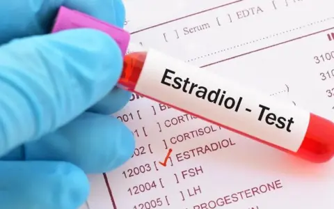 Ręka w niebieskiej rękawiczce trzyma probówkę z napisem "Estradiol - Test". Obok widoczny formularz z zaznaczonym polem ESTRADIOL, sugerującym wysoki estradiol.