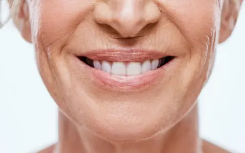 Sonrisa de mujer con piel madura, mostrando cómo disimular el surco nasogeniano con técnicas de maquillaje y cuidado facial.