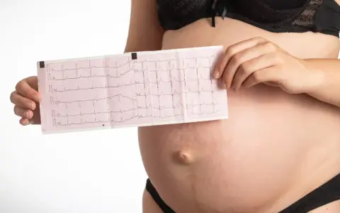 Pancia di donna incinta con elettrocardiogramma che mostra tachicardia. Monitoraggio cardiaco in gravidanza.