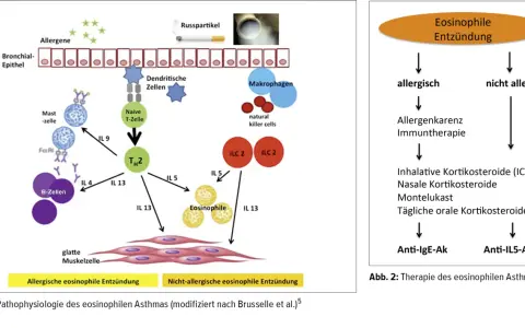 Schema zeigt eosinophile Entzündung bei Asthma: Allergene aktivieren Zellen, die zu TH2-Zellen und Eosinophilen führen. Abb. 2 zeigt Therapieansätze.