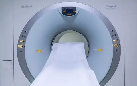 Tomograf komputerowy Siemens Biograph. Badanie może pomóc wykryć nerwiak nerwu słuchowego objawy.