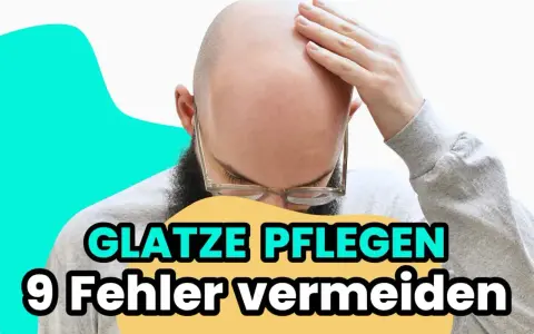 Mann mit Glatze, der sich die Stirn reibt. Text: "Glatze pflegen: 9 Fehler vermeiden".