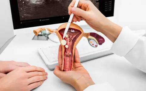 Lekarz pokazuje na modelu narządów rodnych zmiany wskazujące na nadżerkę szyjki macicy, podczas gdy na ekranie widoczny jest obraz z USG.