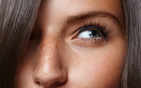 Nahaufnahme eines Gesichts mit Sommersprossen und feinen **Falten unter den Augen**. Dunkles Haar umrahmt das Auge.