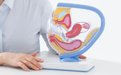 Model anatomiczny narządów rodnych kobiety, z zaznaczonym miejscem na pessar ginekologiczny.