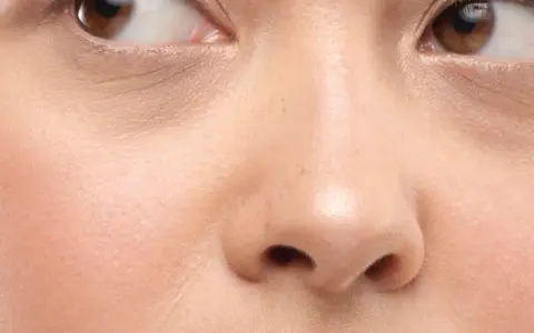 Nahaufnahme eines Gesichts mit braunen Augen und einer normalen Hautstruktur, die leichte Falten um die Augen zeigt.