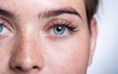Gros plan sur un visage de femme aux yeux bleus et à la peau tachetée de rousseur. Ses cils courts et peu fournis encadrent un regard intense.