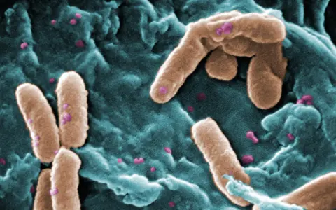 Immagine al microscopio elettronico di Pseudomonas aeruginosa, un batterio contagioso che si presenta come bastoncini marroni su uno sfondo bluastro.
