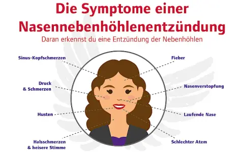 Nebenhöhlenentzündung Symptome: Erkennen Sie die Warnzeichen rechtzeitig