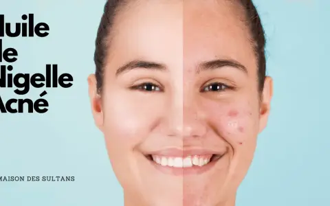 Visage divisé montrant une peau nette et une peau acnéique, avec le texte "Huile de Nigelle Acné".
