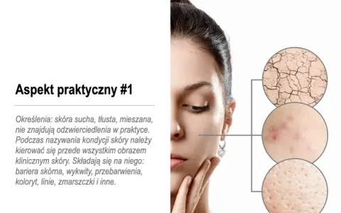 Kobieta z problemami skórnymi: sucha, popękana, z wypryskami i rozszerzonymi porami. To mogą być zaburzenia hormonalne objawy.