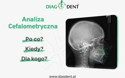 Analiza cefalometryczna: zdjęcie RTG czaszki z naniesionymi liniami i kątami. Pytania: Po co? Kiedy? Dla kogo?