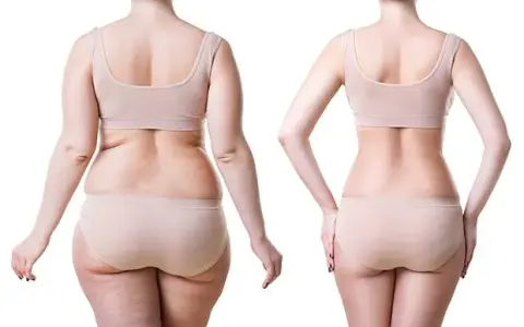 Liposukcja: Ile kg tłuszczu usuniesz? Modeluj, nie odchudzaj!