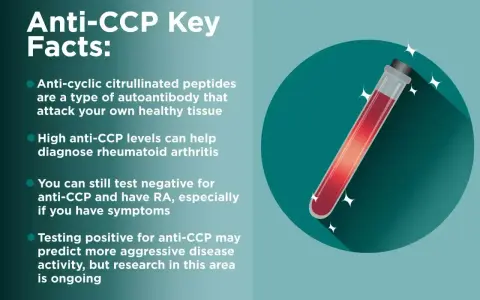 Kluczowe fakty o anty-CCP: przeciwciała atakujące tkanki, wysoki poziom anty-CCP pomaga diagnozować RZS. Test anty-CCP może przewidywać agresywność choroby.
