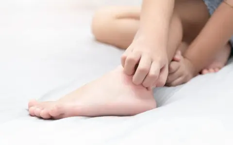 Un enfant se gratte les jambes qui démangent le soir, cherchant un peu de répit avant de dormir.