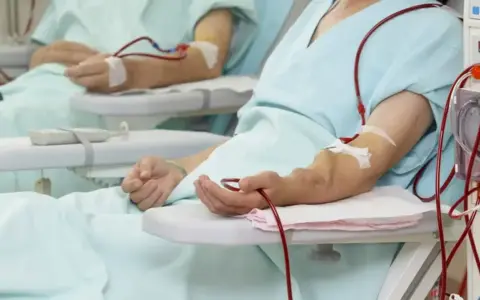 Pacjenci podłączeni do aparatury dializacyjnej. Czy dializa boli? To zależy od indywidualnego progu bólu i rodzaju zabiegu.