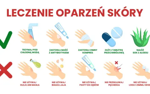 Co na oparzenie wrzątkiem domowe sposoby: chłodna woda, maść z antybiotykiem, zimny kompres, aloes. Unikaj masła, jajka, pasty do zębów, lodu.