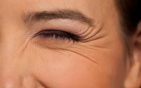 Primer plano de un ojo cerrado con maquillaje, mostrando las arrugas debajo de los ojos que marcan la expresión.