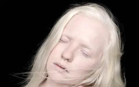Portret albinosa z blond włosami i zamkniętymi oczami na czarnym tle.