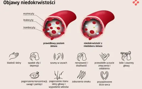 Porównanie poziomu żelaza: prawidłowy vs. niedobór. Niedobór żelaza objawia się m.in. bladością skóry, zmęczeniem, bólami głowy.