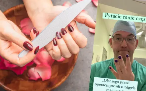 Paznokcie przed operacją? Lekarz w kitlu pokazuje pomalowane paznokcie, odpowiadając na pytanie, czy do operacji można mieć pomalowane paznokcie.
