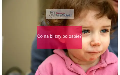Twarz dziecka z widocznymi śladami po ospie. Napis "Co na blizny po ospie?" sugeruje poszukiwanie rozwiązań.