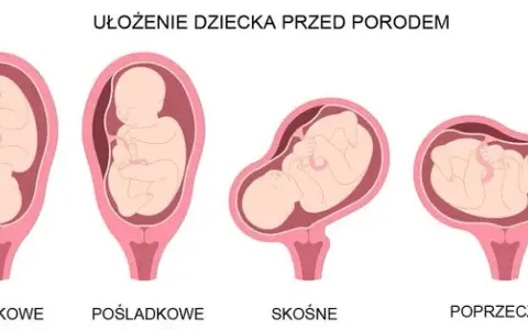 Kiedy dziecko obraca się główką w dół? Poznaj kluczowe informacje