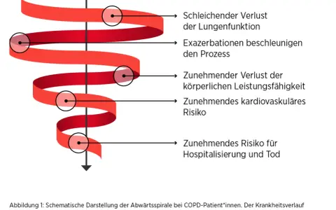 Abwärtsspirale bei COPD: schleichender Lungenfunktionsverlust, Exazerbationen, körperliche Leistungseinbußen, kardiovaskuläres Risiko, Hospitalisierung. Gewichtsverlust ist ein Zeichen des Endstadiums.