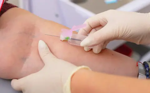 Pobieranie krwi do badania, które może wykazać, czy limfocyty podwyższone u dorosłego wymagają dalszej diagnostyki.