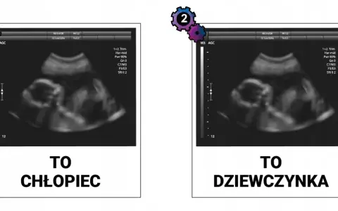 Jak rozpoznać płeć dziecka na USG? Kiedy i na co patrzy lekarz?