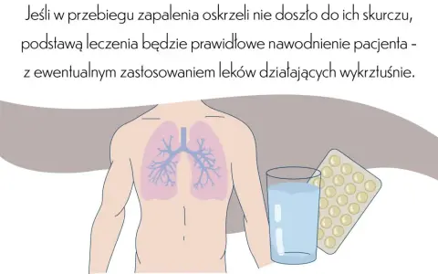 Kiedy hospitalizować dziecko z zapaleniem oskrzeli? Objawy i porady