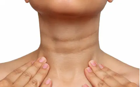 Cuello con piel oscura y arrugada, indicativo de acantosis nigricans. Se buscan opciones de tratamiento.