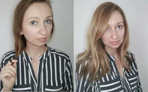 Frau mit dünnem Haar, das auf Haarausfall bei Frauen hindeutet, im Vergleich zu vollerem, längerem Haar.