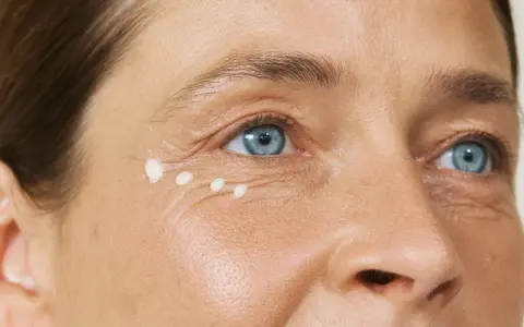 Augenpartie einer Frau über 40 mit feinen Linien und aufgetupfter Creme.