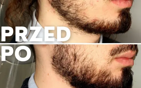 Gęsty zarost: Jak szybko rośnie i co realnie przyspieszy brodę?