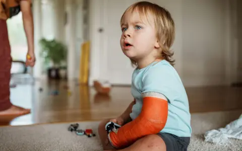 Kleiner Junge mit einem orangefarbenen Gips am Arm, der nachdenklich auf den Boden schaut. Er hat einen **kind arm gebrochen**.