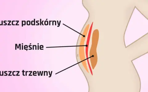 Ilustracja pokazuje przekrój brzucha, gdzie widać jak wygląda tłuszcz na brzuchu: podskórny i trzewny, oddzielone mięśniami.