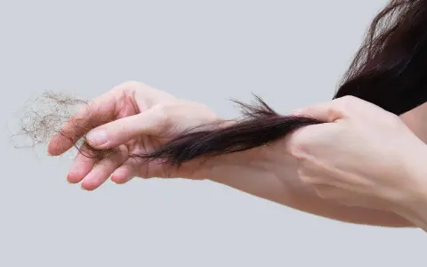 Mani che mostrano perdita capelli allattamento, cercando rimedi naturali per rinforzare i capelli indeboliti.
