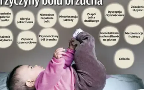 Dziecko z podkurczonymi nóżkami, nad którym widnieją kółka z przyczynami bólu brzucha u dziecka, np. nietolerancja laktozy.
