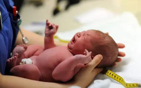 Neugeborenes Baby schreit, die Kopfform ist gut sichtbar. Ein Maßband liegt um den Kopf, wie nach einer Geburt mit Saugglocke.