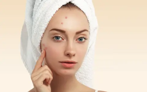 Pryszcz którego nie da się wycisnąć: przyczyny i skuteczne leczenie